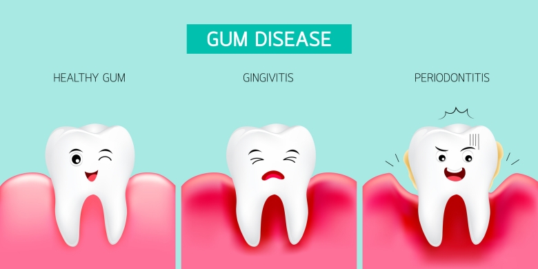 progression of gum disease